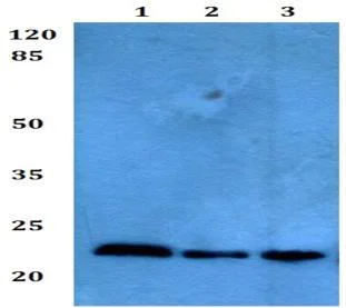 Western blot - Anti-Troponin T1/TNT antibody (AB193546)