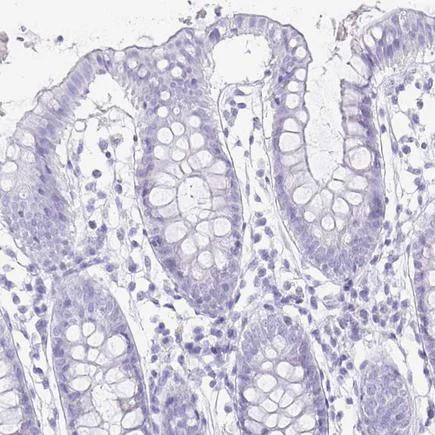 Immunohistochemistry (Formalin/PFA-fixed paraffin-embedded sections) - Anti-Troponin T1/TNT antibody (AB224583)