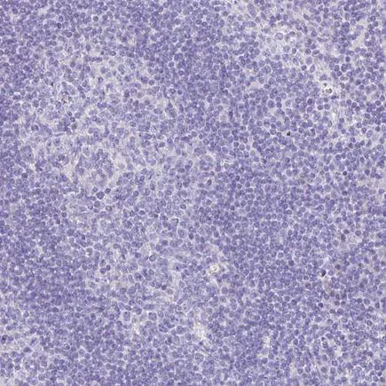 Immunohistochemistry (Formalin/PFA-fixed paraffin-embedded sections) - Anti-Troponin T1/TNT antibody (AB224583)