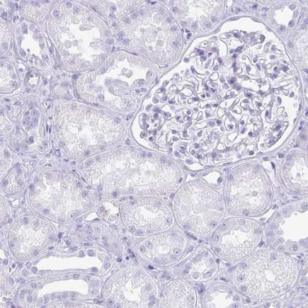 Immunohistochemistry (Formalin/PFA-fixed paraffin-embedded sections) - Anti-Troponin T1/TNT antibody (AB224583)