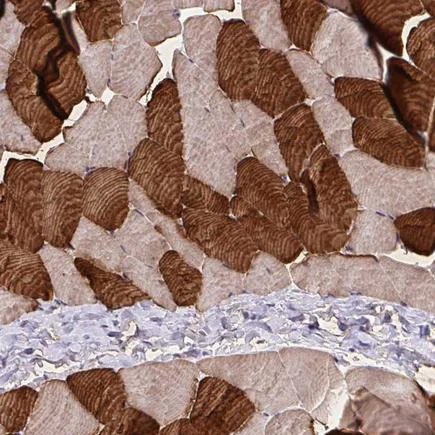 Immunohistochemistry (Formalin/PFA-fixed paraffin-embedded sections) - Anti-Troponin T1/TNT antibody (AB224583)