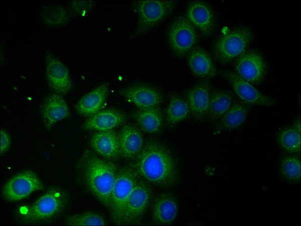 Immunocytochemistry/ Immunofluorescence - Anti-TROVE2/SS-A antibody (AB194004), expandable thumbnail