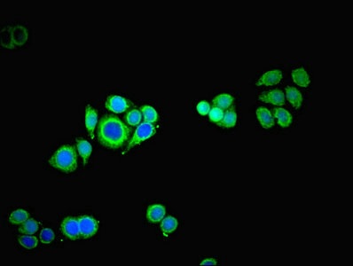 Immunocytochemistry/ Immunofluorescence - Anti-TROVE2/SS-A antibody (AB194004), expandable thumbnail
