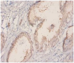 Immunohistochemistry (Formalin/PFA-fixed paraffin-embedded sections) - Anti-TROVE2/SS-A antibody (ab194004), expandable thumbnail