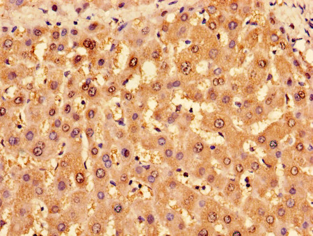 Immunohistochemistry (Formalin/PFA-fixed paraffin-embedded sections) - Anti-TROVE2/SS-A antibody (AB194004), expandable thumbnail