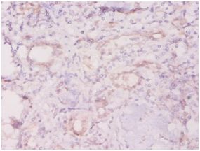 Immunohistochemistry (Formalin/PFA-fixed paraffin-embedded sections) - Anti-TROVE2/SS-A antibody (ab194004), expandable thumbnail