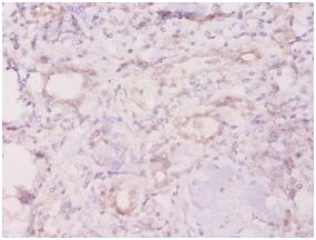 Immunohistochemistry (Formalin/PFA-fixed paraffin-embedded sections) - Anti-TROVE2/SS-A antibody (AB194004)
