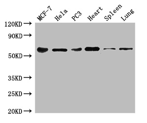 Western blot - Anti-TROVE2/SS-A antibody (AB194004), expandable thumbnail