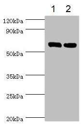 Western blot - Anti-TROVE2/SS-A antibody (AB194004), expandable thumbnail
