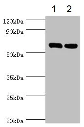 Western blot - Anti-TROVE2/SS-A antibody (AB194004)