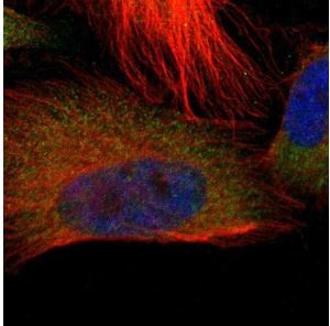 Immunocytochemistry/ Immunofluorescence - Anti-TROVE2/SS-A antibody (AB219973)