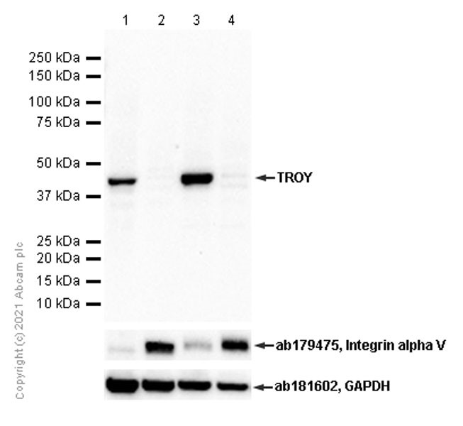 Western blot - Anti-TROY antibody [EPR3214(2)] (AB137080), expandable thumbnail