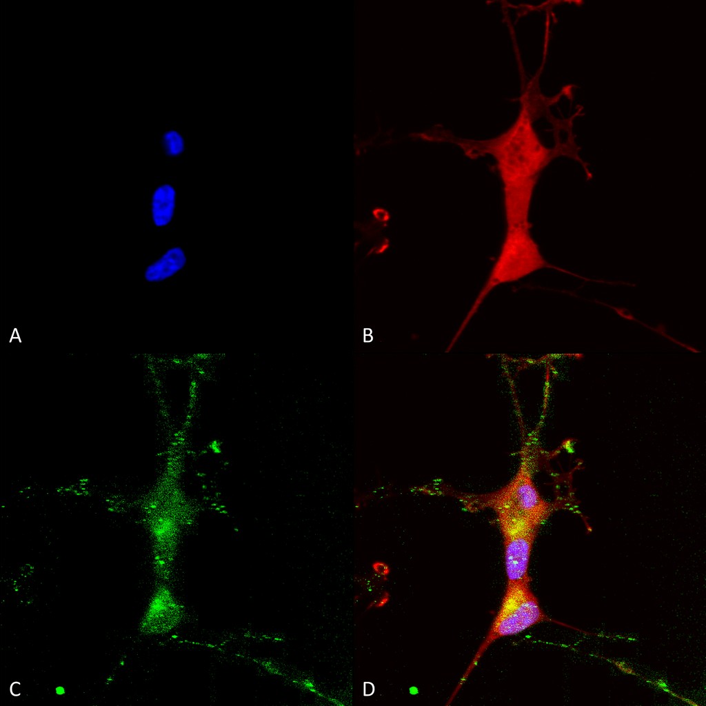 Immunocytochemistry/ Immunofluorescence - Anti-TRP 7 antibody [N64A/36] (AB93618)