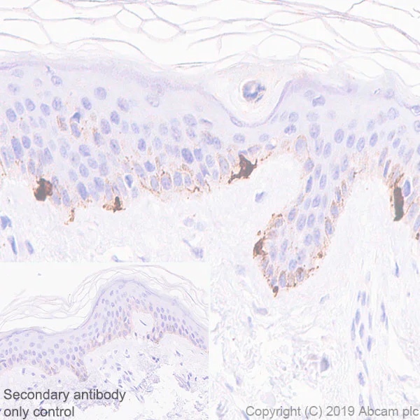 Immunohistochemistry (Formalin/PFA-fixed paraffin-embedded sections) - Anti-TRP1 antibody [EPR13063] (AB178676)
