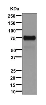 Western blot - Anti-TRP1 antibody [EPR13063] (AB178676)