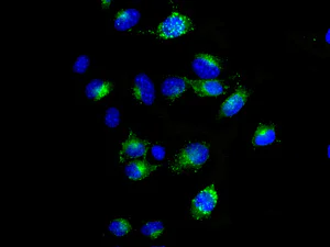 Immunocytochemistry/ Immunofluorescence - Anti-TRP1 antibody [EPR13063] - BSA and Azide free (AB186929)