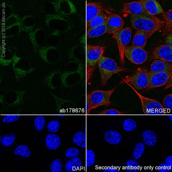 Immunocytochemistry/ Immunofluorescence - Anti-TRP1 antibody [EPR13063] - BSA and Azide free (AB186929)