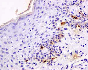 Immunohistochemistry (Formalin/PFA-fixed paraffin-embedded sections) - Anti-TRP1 antibody [EPR13063] - BSA and Azide free (AB186929)