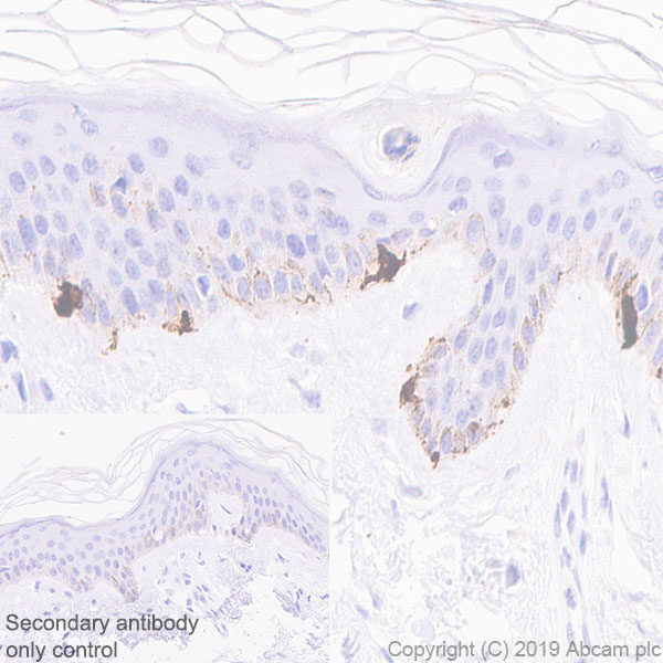 Immunohistochemistry (Formalin/PFA-fixed paraffin-embedded sections) - Anti-TRP1 antibody [EPR13063] - BSA and Azide free (AB186929)