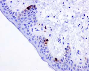 Immunohistochemistry (Formalin/PFA-fixed paraffin-embedded sections) - Anti-TRP1 antibody [EPR13064(B)] - BSA and Azide free (AB249974)