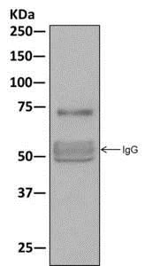 Immunoprecipitation - Anti-TRP1 antibody [EPR13064(B)] - BSA and Azide free (AB249974)