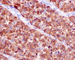 Immunohistochemistry (Formalin/PFA-fixed paraffin-embedded sections) - Anti-TRP1 antibody [EPR13064(B)] - C-terminal (AB177468)