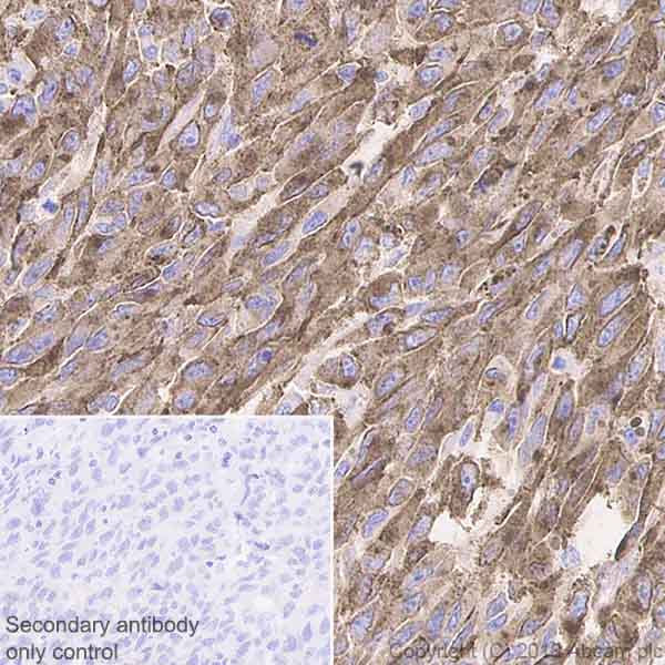Immunohistochemistry (Formalin/PFA-fixed paraffin-embedded sections) - Anti-TRP1 antibody [EPR21956] (AB235446)