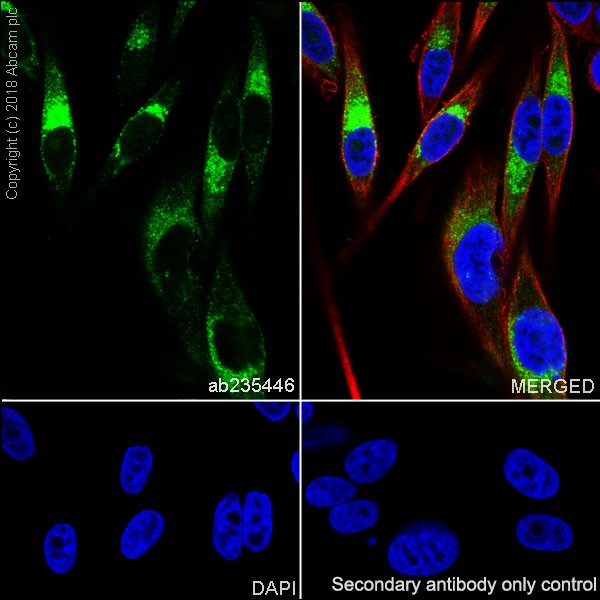 Immunocytochemistry/ Immunofluorescence - Anti-TRP1 antibody [EPR21956] - BSA and Azide free (AB238461)