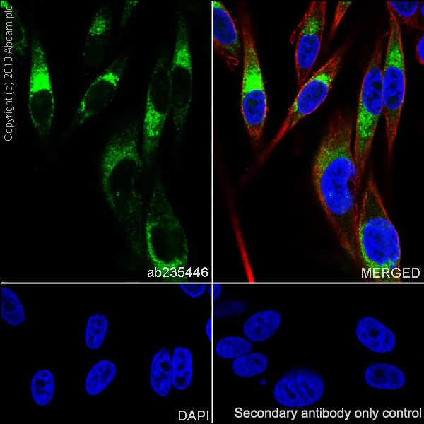 Immunocytochemistry/ Immunofluorescence - Anti-TRP1 antibody [EPR21956] - BSA and Azide free (AB238461)