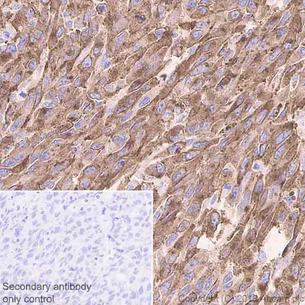 Immunohistochemistry (Formalin/PFA-fixed paraffin-embedded sections) - Anti-TRP1 antibody [EPR21956] - BSA and Azide free (AB238461)