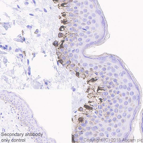 Immunohistochemistry (Formalin/PFA-fixed paraffin-embedded sections) - Anti-TRP1 antibody [EPR21956] - BSA and Azide free (AB238461)
