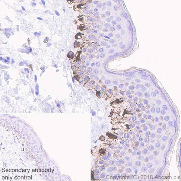 Immunohistochemistry (Formalin/PFA-fixed paraffin-embedded sections) - Anti-TRP1 antibody [EPR21956] - BSA and Azide free (AB238461)