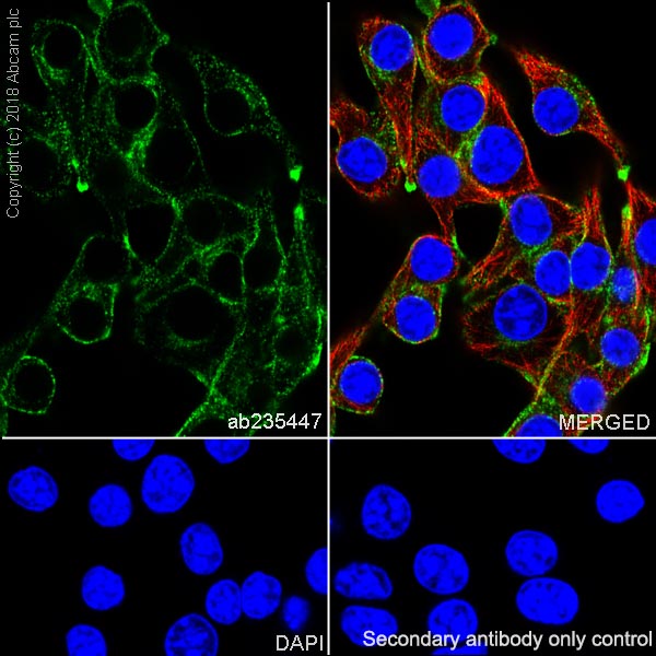 Immunocytochemistry/ Immunofluorescence - Anti-TRP1 antibody [EPR21960] (AB235447), expandable thumbnail