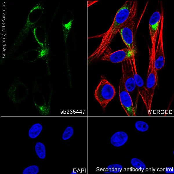 Immunocytochemistry/ Immunofluorescence - Anti-TRP1 antibody [EPR21960] (AB235447)