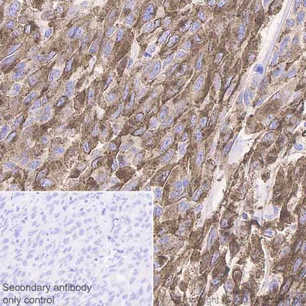 Immunohistochemistry (Formalin/PFA-fixed paraffin-embedded sections) - Anti-TRP1 antibody [EPR21960] (ab235447), expandable thumbnail