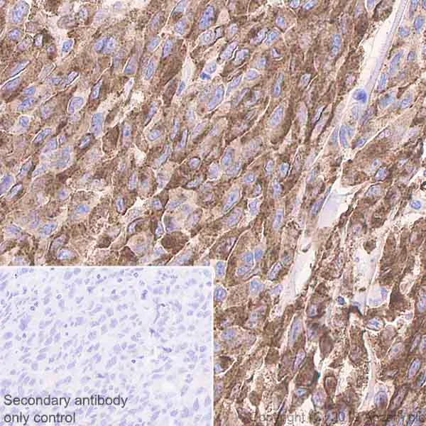 Immunohistochemistry (Formalin/PFA-fixed paraffin-embedded sections) - Anti-TRP1 antibody [EPR21960] (AB235447)