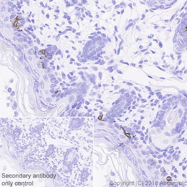 Immunohistochemistry (Formalin/PFA-fixed paraffin-embedded sections) - Anti-TRP1 antibody [EPR21960] (AB235447), expandable thumbnail