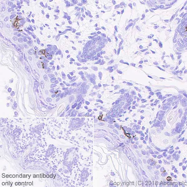 Immunohistochemistry (Formalin/PFA-fixed paraffin-embedded sections) - Anti-TRP1 antibody [EPR21960] (AB235447)