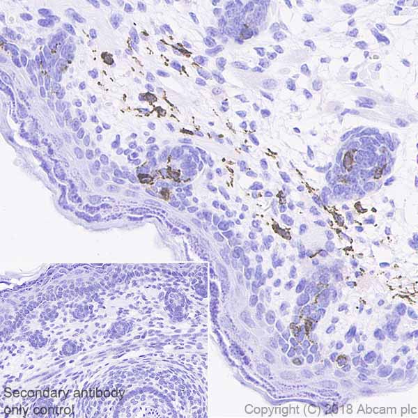 Immunohistochemistry (Formalin/PFA-fixed paraffin-embedded sections) - Anti-TRP1 antibody [EPR21960] (ab235447), expandable thumbnail