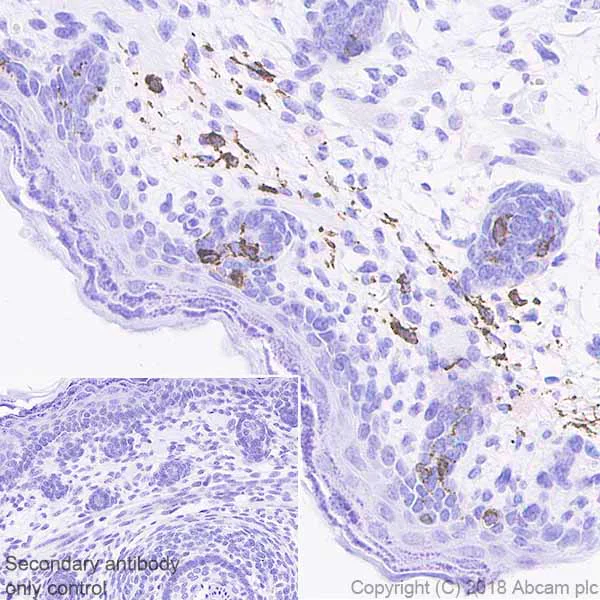 Immunohistochemistry (Formalin/PFA-fixed paraffin-embedded sections) - Anti-TRP1 antibody [EPR21960] (AB235447)