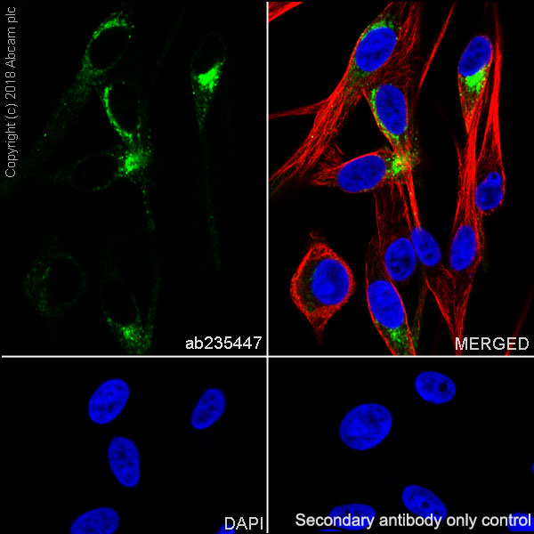 Immunocytochemistry/ Immunofluorescence - Anti-TRP1 antibody [EPR21960] - BSA and Azide free (AB238418)