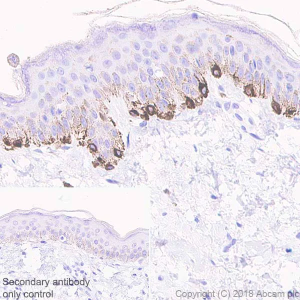 Immunohistochemistry (Formalin/PFA-fixed paraffin-embedded sections) - Anti-TRP1 antibody [EPR21960] - BSA and Azide free (AB238418)