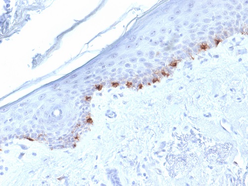 Immunohistochemistry (Formalin/PFA-fixed paraffin-embedded sections) - Anti-TRP1 antibody [TYRP1/1986] (AB224658)