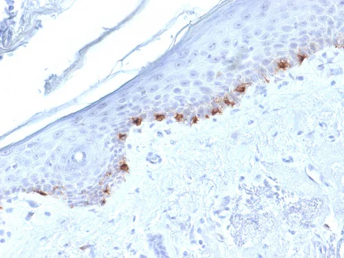 Immunohistochemistry (Formalin/PFA-fixed paraffin-embedded sections) - Anti-TRP1 antibody [TYRP1/1986] (AB224658)