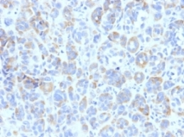Immunohistochemistry (Formalin/PFA-fixed paraffin-embedded sections) - Anti-TRP1 antibody [TYRP1/807] (AB218330)