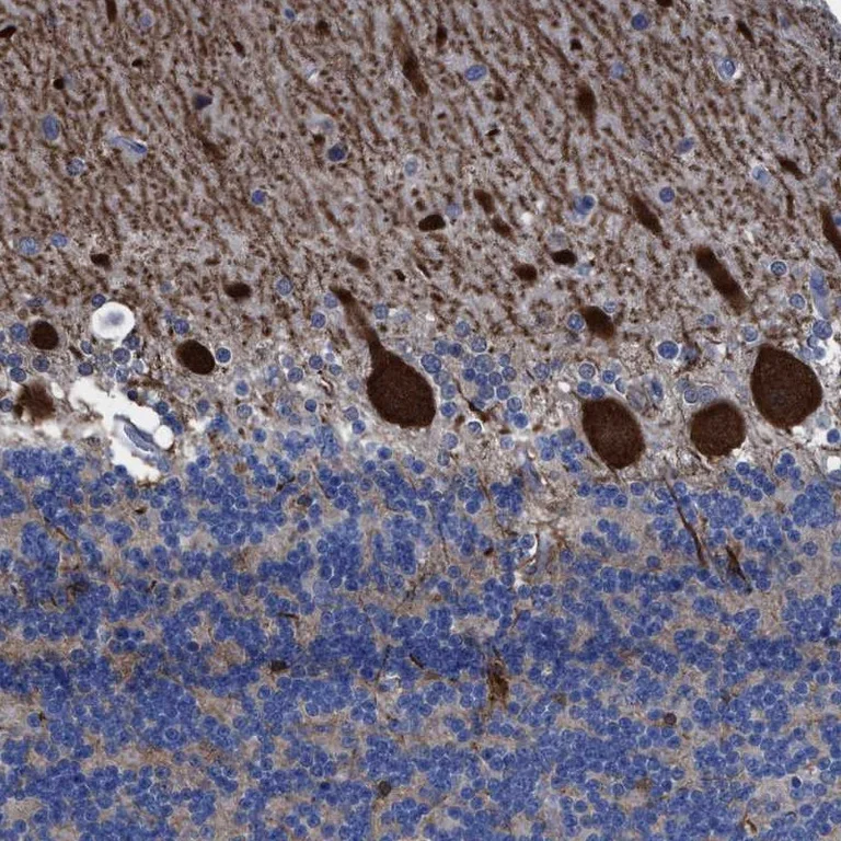 Immunohistochemistry (Formalin/PFA-fixed paraffin-embedded sections) - Anti-TRP14 antibody (AB121725)