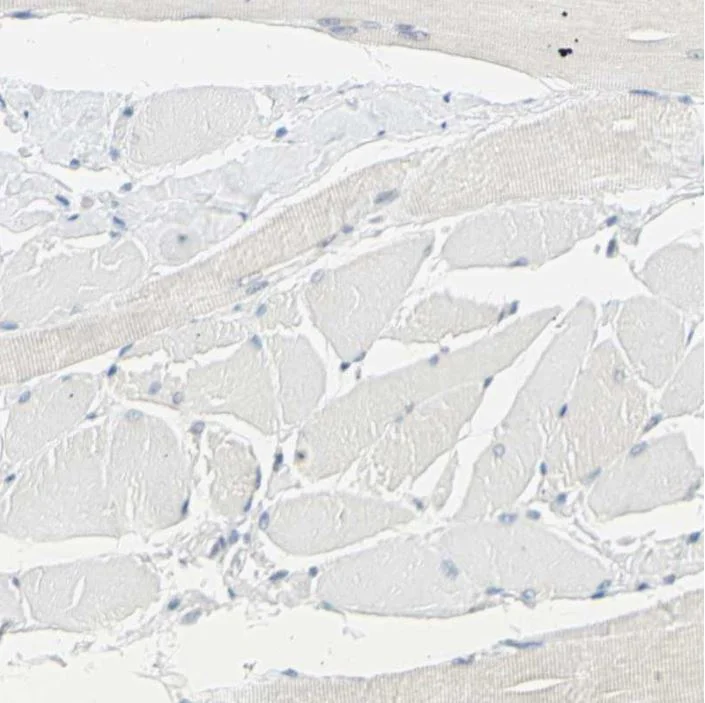 Immunohistochemistry (Formalin/PFA-fixed paraffin-embedded sections) - Anti-TRP2/DCT antibody (AB223736)