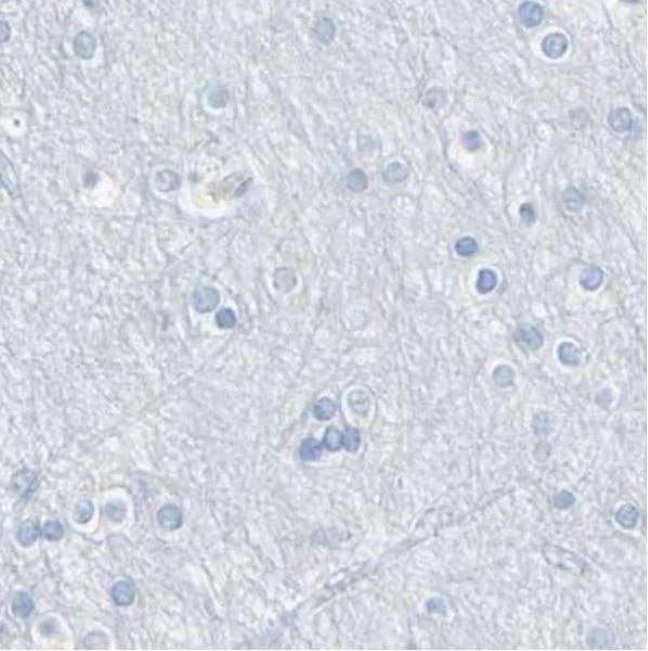 Immunohistochemistry (Formalin/PFA-fixed paraffin-embedded sections) - Anti-TRP2/DCT antibody (AB223736)