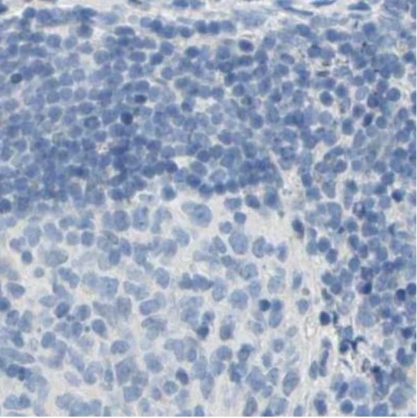 Immunohistochemistry (Formalin/PFA-fixed paraffin-embedded sections) - Anti-TRP2/DCT antibody (AB223736)
