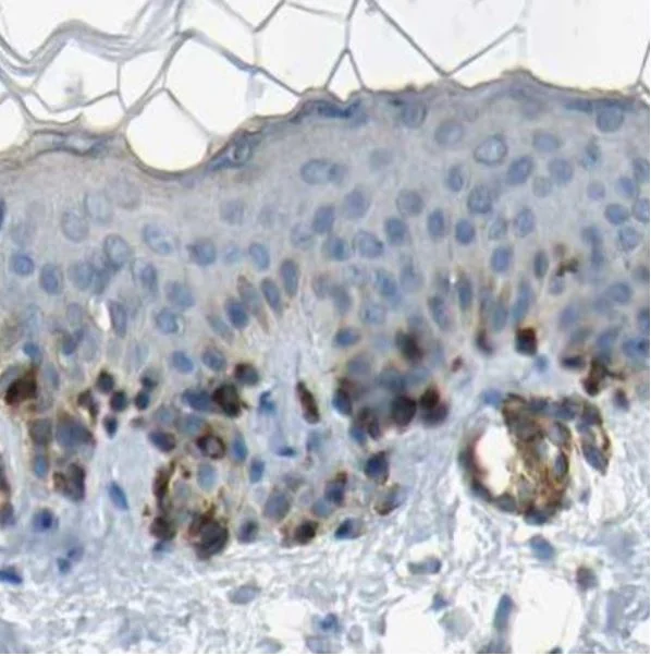 Immunohistochemistry (Formalin/PFA-fixed paraffin-embedded sections) - Anti-TRP2/DCT antibody (AB223736)